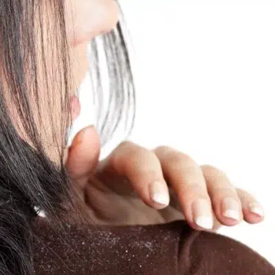 Hindistan Cevizi Yağının Saça Olan 7 Faydası